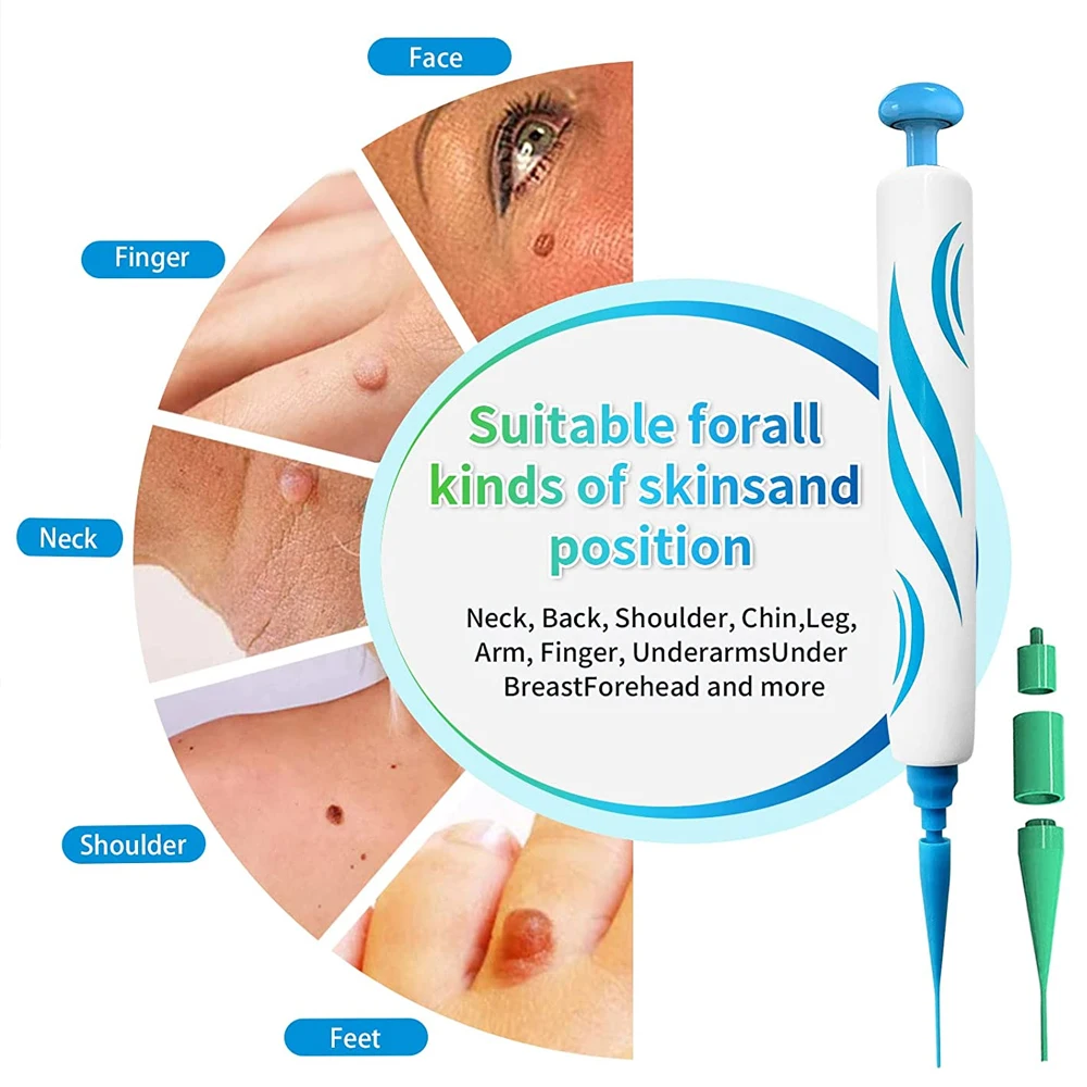 2 IN 1 Auto Micro Skin Tag Rem - Skincare Ingredients Checker recensie en prijs