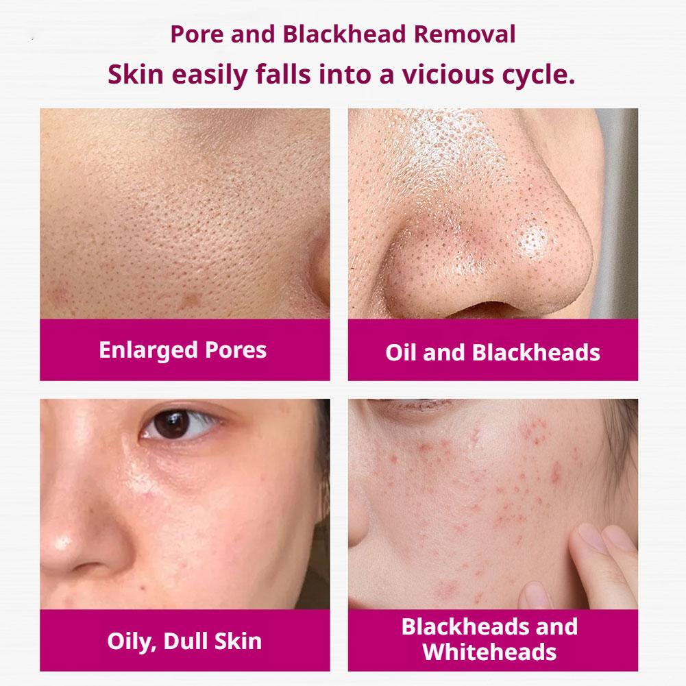 Salicylzuur Serum voor het ver - Glycolic Acid Exfoliant recensie en prijs