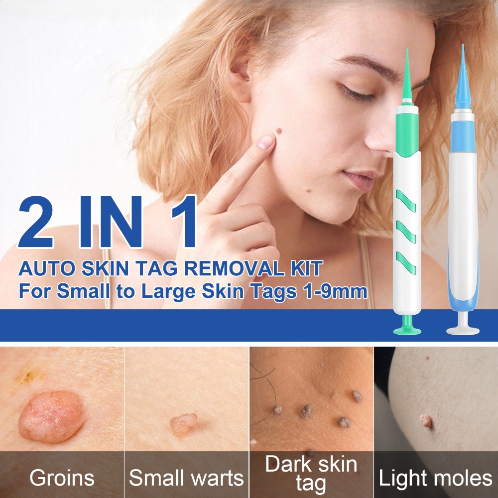 2-IN-1 Auto Skin Tag Removal T - Skincare Ingredients Checker recensie en prijs