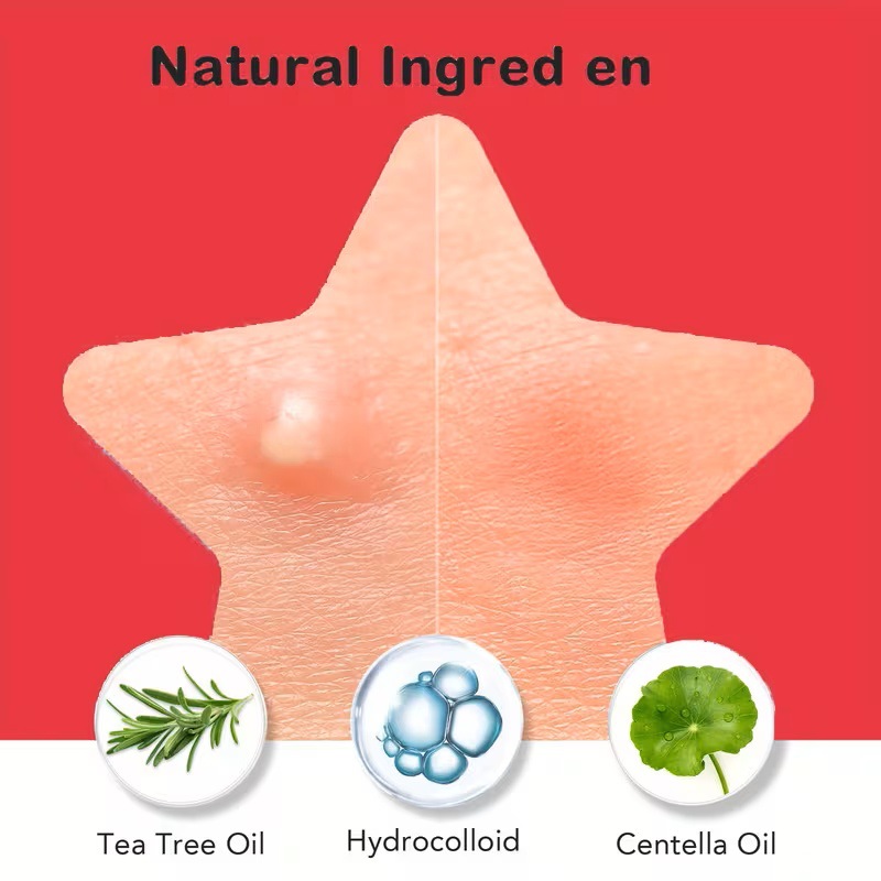 200/400 stuks Acnepleisters vo - Skincare Oil Control recensie en prijs