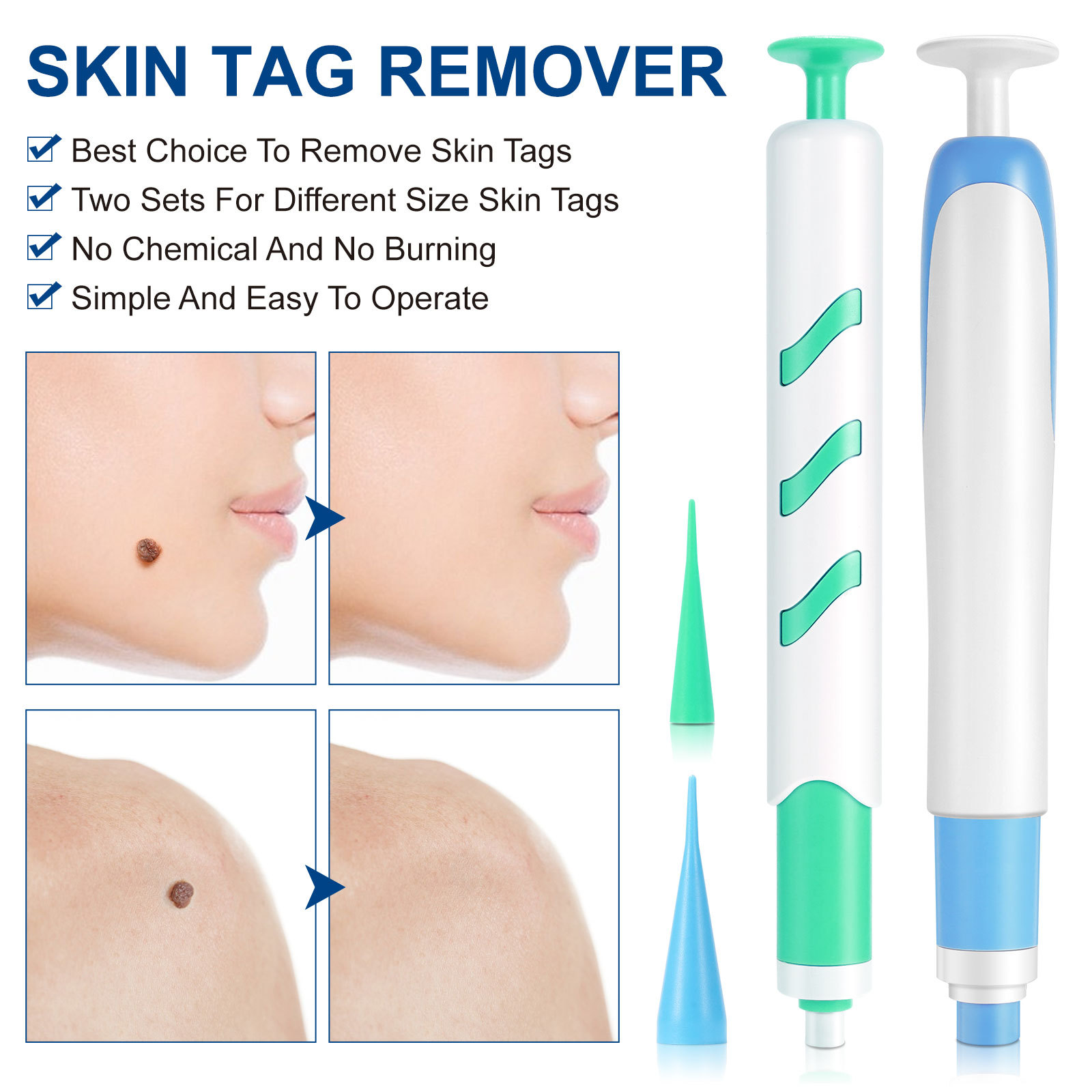 2-IN-1 Auto Skin Tag Removal K - Skincare Ingredients Checker recensie en prijs