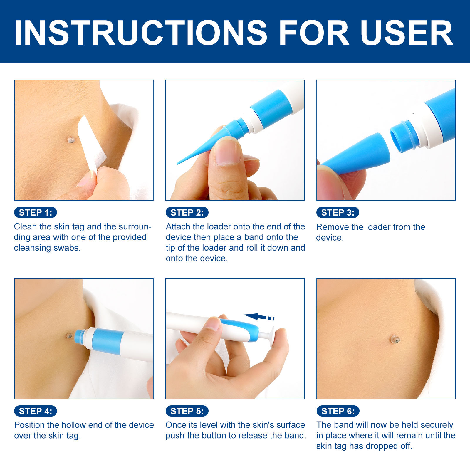 2-IN-1 Auto Skin Tag Removal K - Skincare Ingredients Checker recensie en prijs