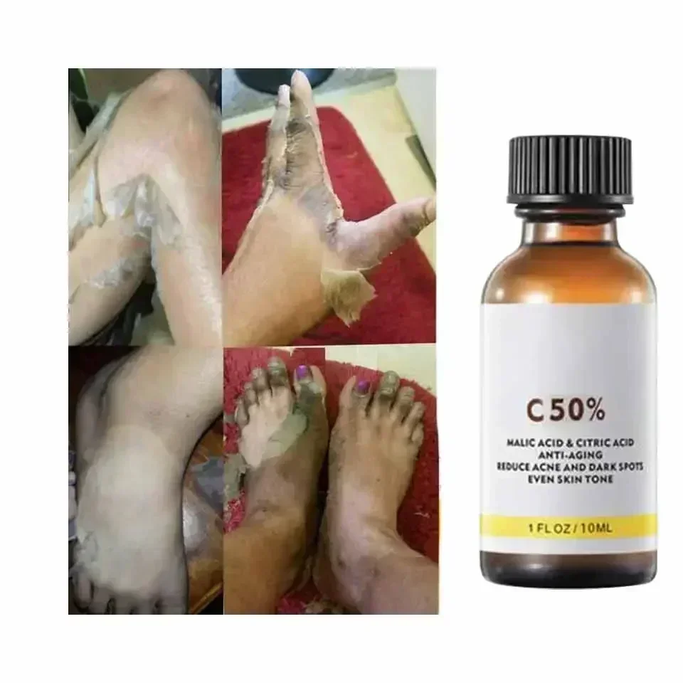 Met Maliczuur en Citroenzuur V - Licorice Root Extract recensie en prijs